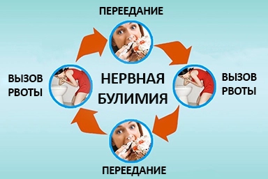 Лечение булимии в Плавске